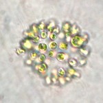 Microcystis aeruginosa