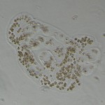 Microcystis wesenbergii