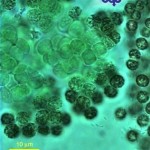 Microcystis flos-aquae